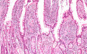 Dünndarmzotten im mikroskopischen Bild Nephron, CC BY-SA 3.0, via Wikimedia Commons