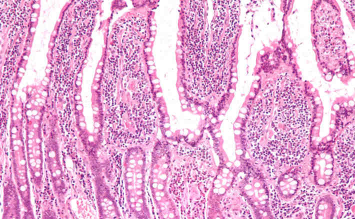 Dünndarmzotten im mikroskopischen Bild Nephron, CC BY-SA 3.0, via Wikimedia Commons