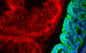 Mikroskopische Aufnahme von Darmgewebe. Grün: Epithelzellen, die HK2 produzieren. Rot: Bakterien im Inneren des Darmes. © Saskia Weber-Stiehl, IKMB, Uni Kiel