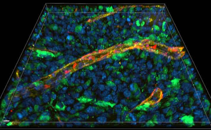 Mikroskopische Analyse eines 16µm dicken Schnitts durch ein Gewebe, in dem der Immunbotenstoff Interferon gamma (IFNγ) freigesetzt wurde: Die Zellkerne des Gewebes sind blau zu sehen, das Interferon grün, Blutgefäße gelb und das Heparansulfat rot. Orange erscheinen Bereiche, in denen Interferon das Heparansulfat bindet. Der Maßstab-Balken markiert 10µm im Schnitt. Foto: AG Blankenstein, Technologieplattform „Advanced Light Microscopy“, Max Delbrück Center