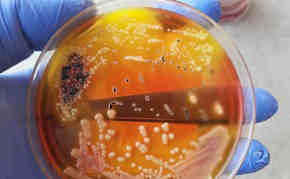 Fecal microbes growth on Xylose Lysine Deoxycholate (XLD) Agar after over night incubation, Ajay Kumar Chaurasiya
