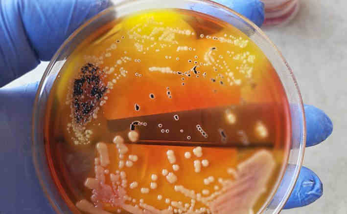 Fecal microbes growth on Xylose Lysine Deoxycholate