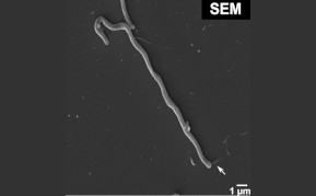 Elektronenmikroskopisches Bild von Taurinivorans muris in Reinkultur C: Huimin Ye